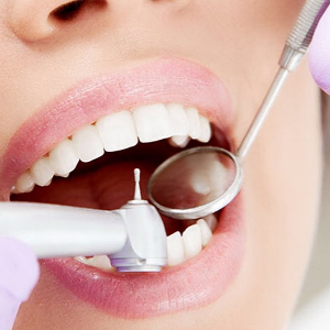 Лечение зубов в Щелково - цены от Бюлинг Лечение зубов в Щелково - цены от Бюлинг