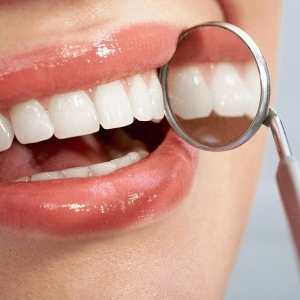 Виниры Виниры